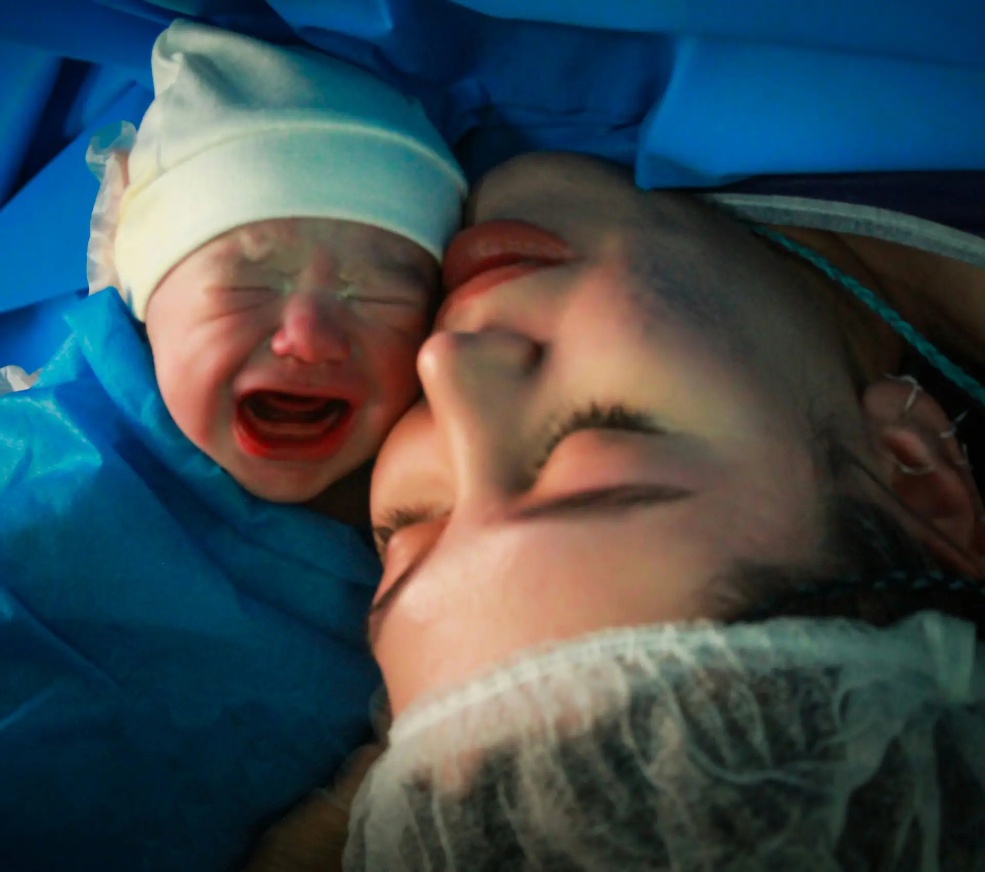A newborn baby crying next to their mother, who is lying down with her eyes closed, both wearing hospital caps and surrounded by blue surgical drapes after a circumcision procedure.
