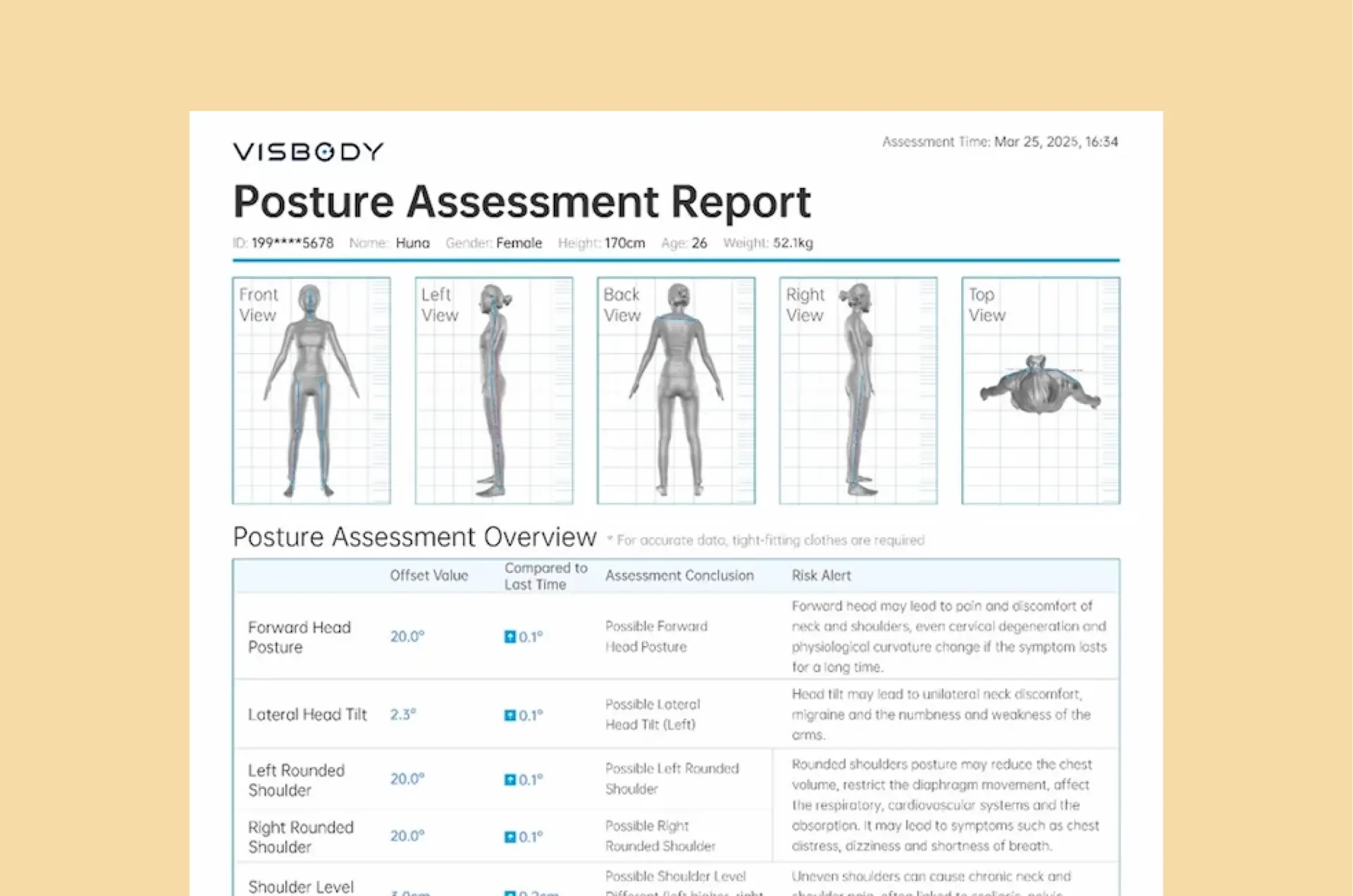 A posture assessment report for a 29-year-old male shows six body diagrams from different angles and a table summarising head and shoulder alignment, posture conclusions, and risk alerts.